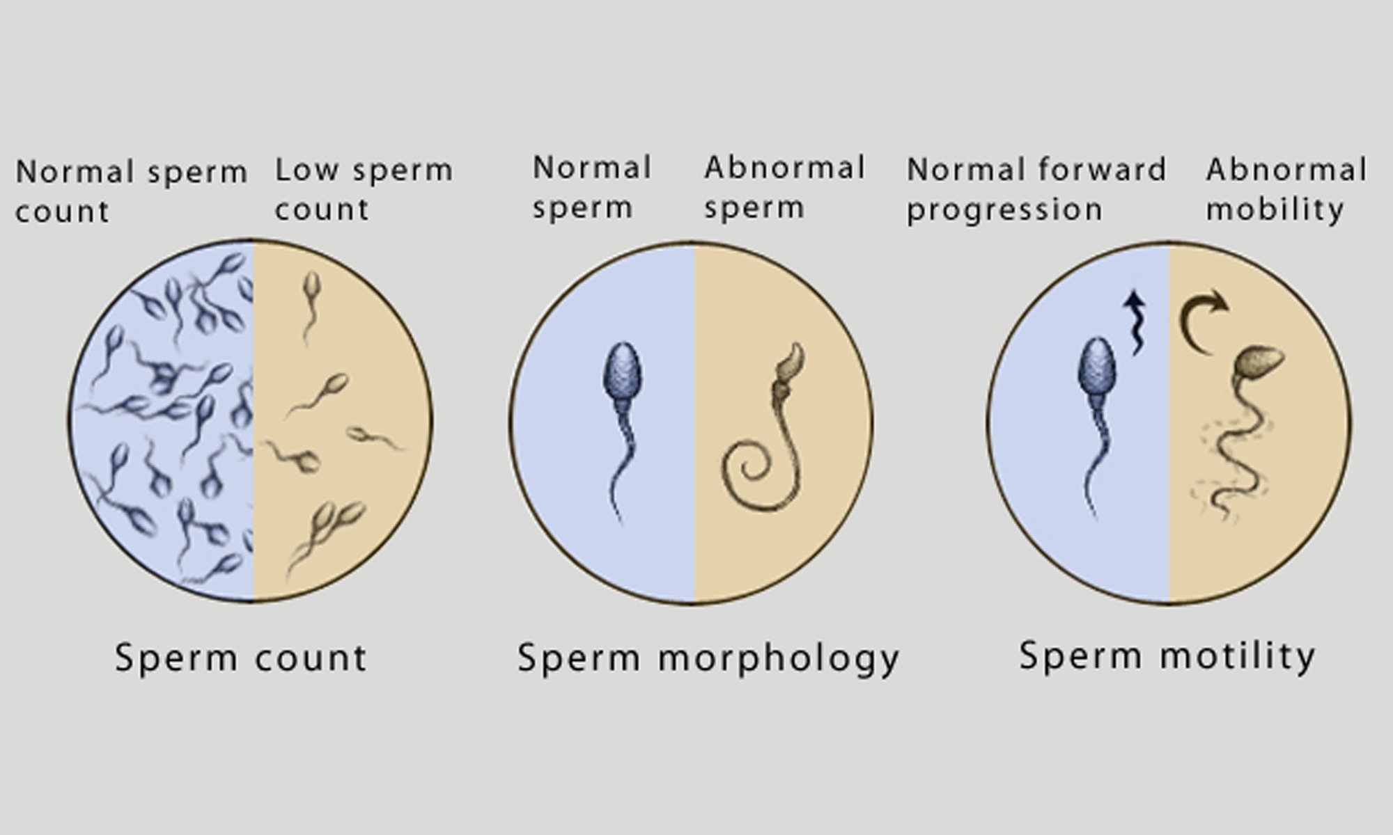 Sperm Quality Analysis